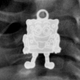 Illustration for article titled The Mystery Of What This Toddler Swallowed Was Quickly Solved
